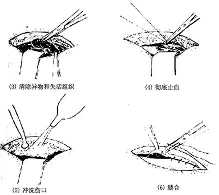 崴